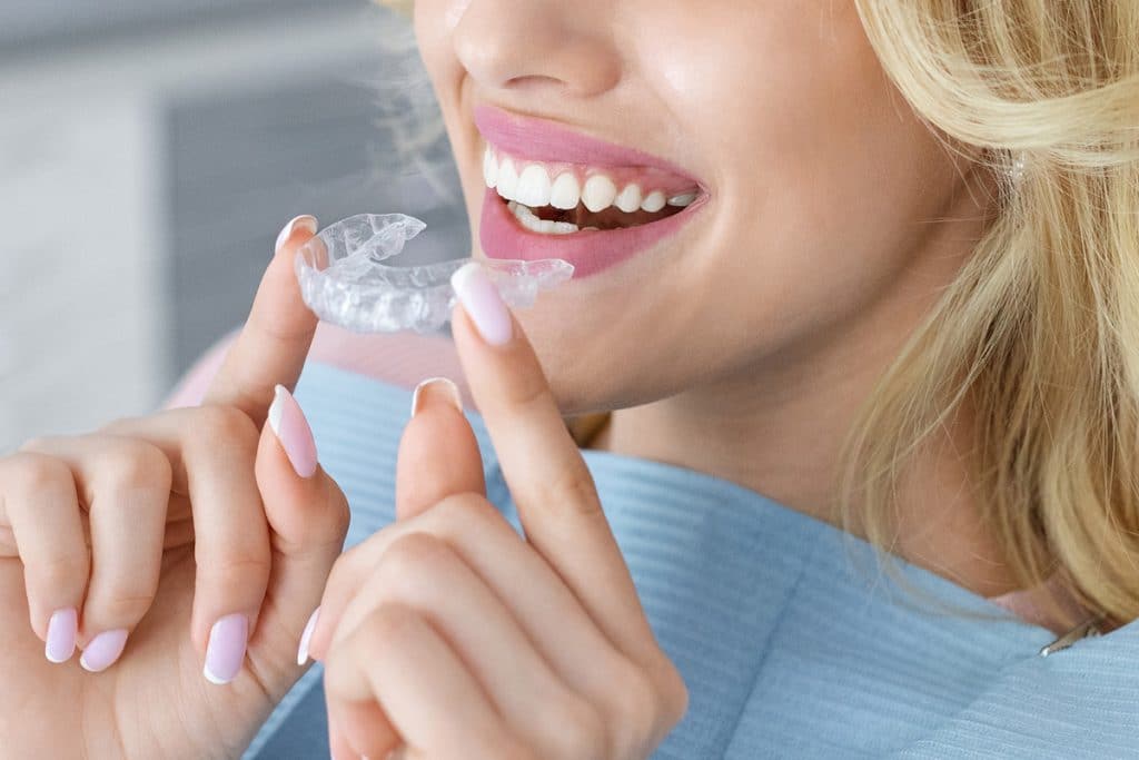 Clear Aligners vs Metal