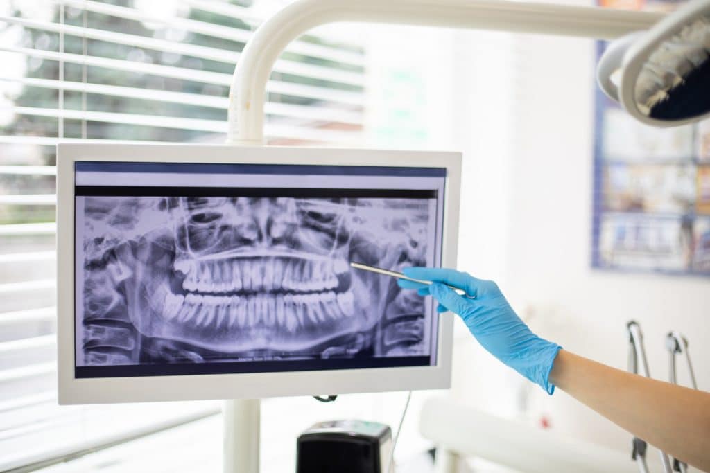 Dental radiogram