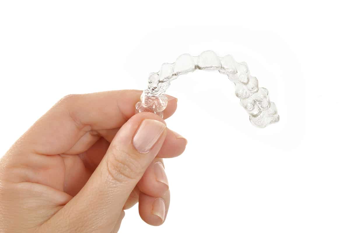 How Long Do You Have To Wear Clear Aligners? Altitude Dental