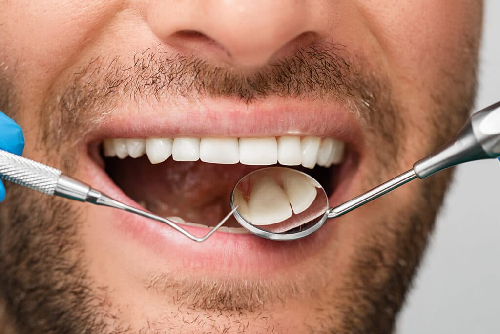 Signs Your Gums May Need Periodontal Care
